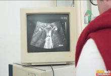 Qua màn hình siêu âm chồng lu mờ với dụng cụ khám thai của bác sĩ